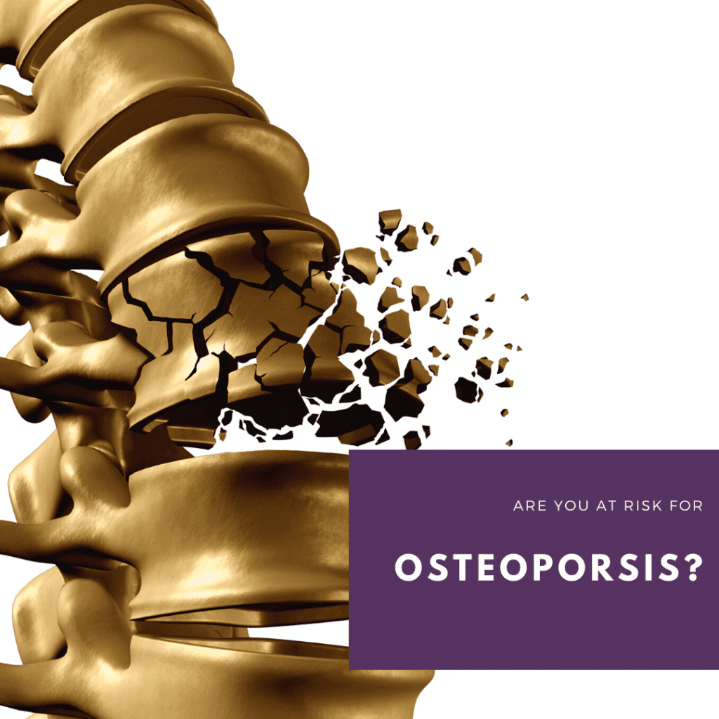 Are you at risk for osteoporosis2